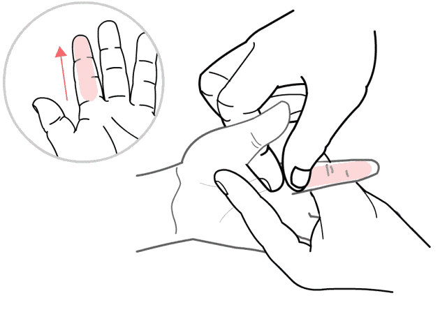 手足口病的最佳治疗方法（当手足口病来袭 , 别慌！这个方法安全有效）(图4)