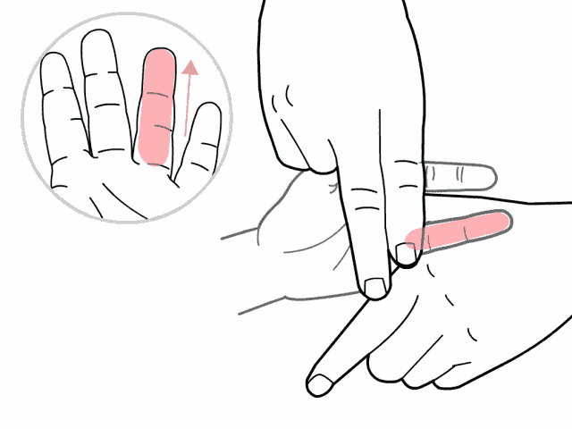 手足口病的最佳治疗方法（当手足口病来袭 , 别慌！这个方法安全有效）(图5)