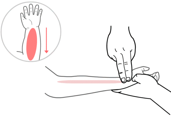 手足口病的最佳治疗方法（当手足口病来袭 , 别慌！这个方法安全有效）(图7)